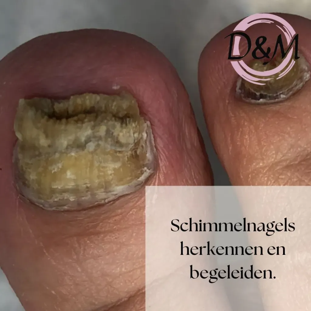 Schimmels herkennen en begeleiden