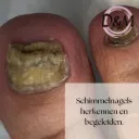 Schimmels herkennen en begeleiden