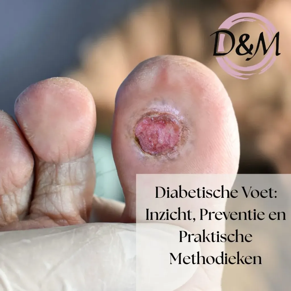 Diabetische Voet: Inzicht, Preventie en Praktische Methodieken