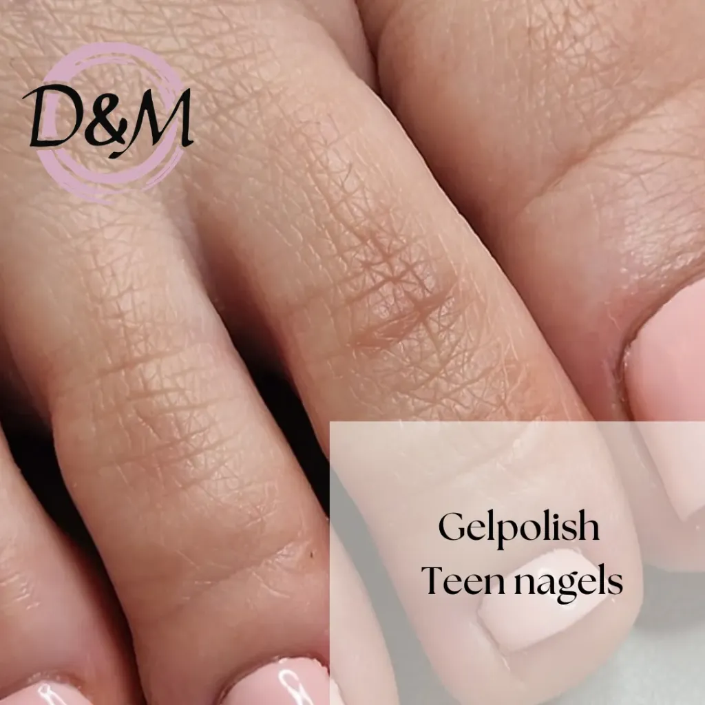 Gelpolish op teennagels